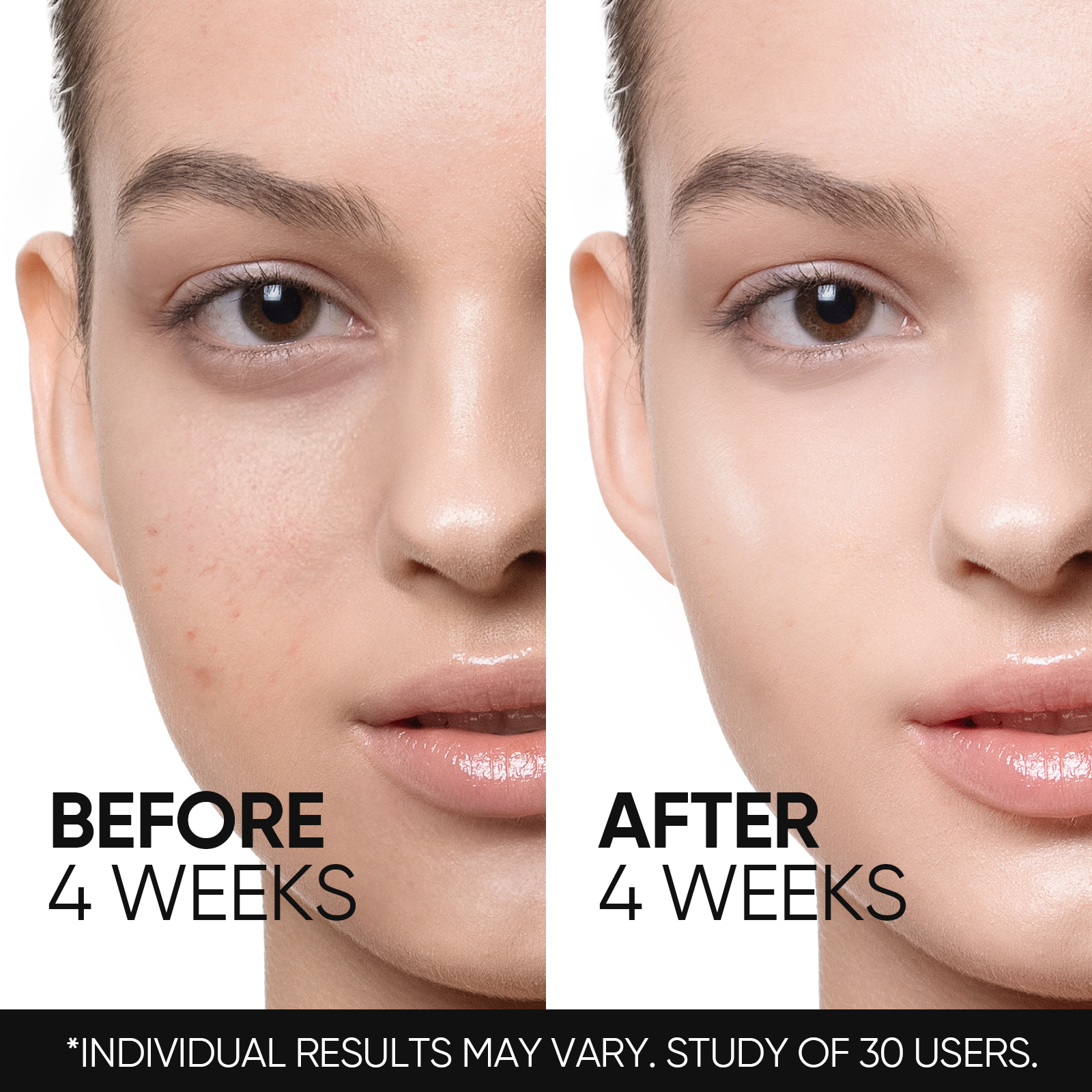 Hidratante Renovador con Retinol