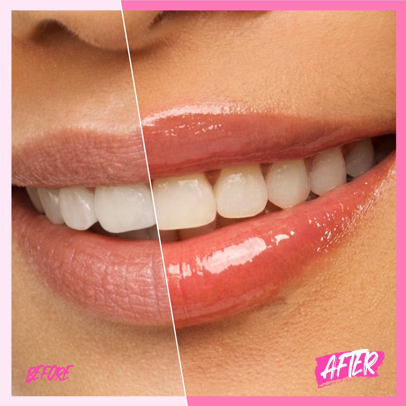 Peptide Brightening Lip Serum