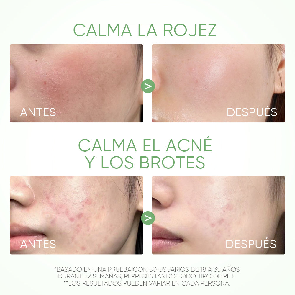 Mascarilla en barra de arcilla con Artemisa anti poros y antiacné