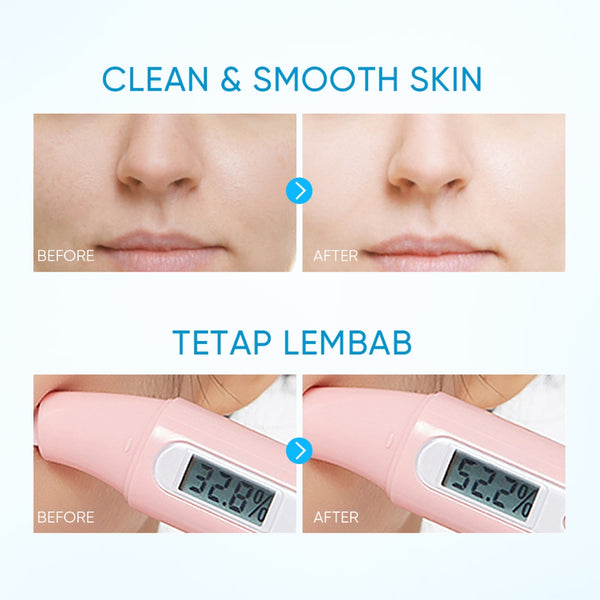 Limpiador facial 5X Ceramidas pH bajo