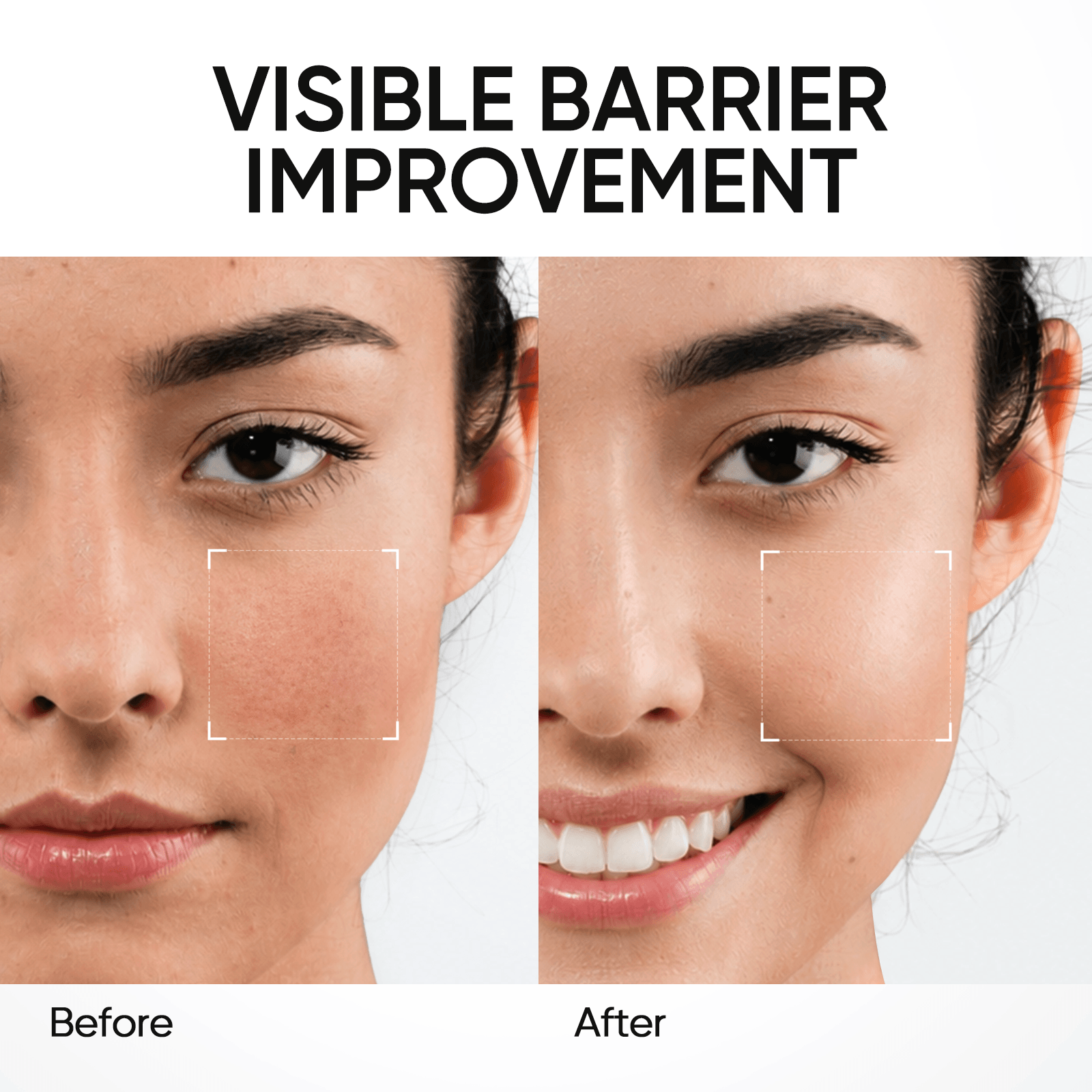 Gel hidratante facial para reforzar la barrera con 5 ceramidas y textura ligera