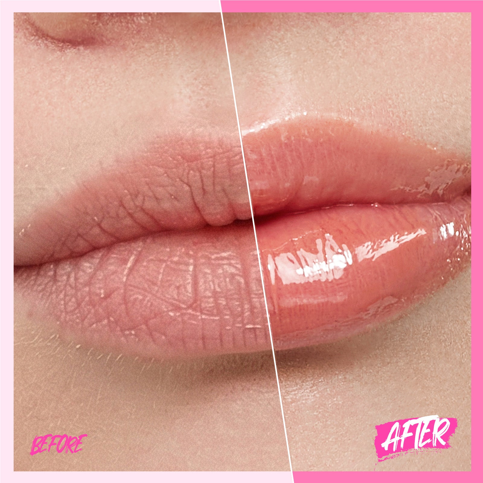 Peptide Brightening Lip Serum