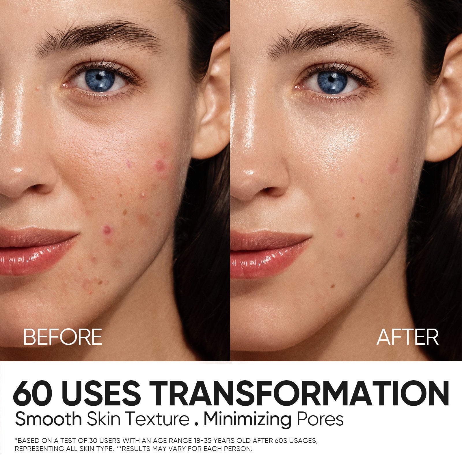 Sérum Exfoliante con 12% AHA, BHA, PHA y LHA
