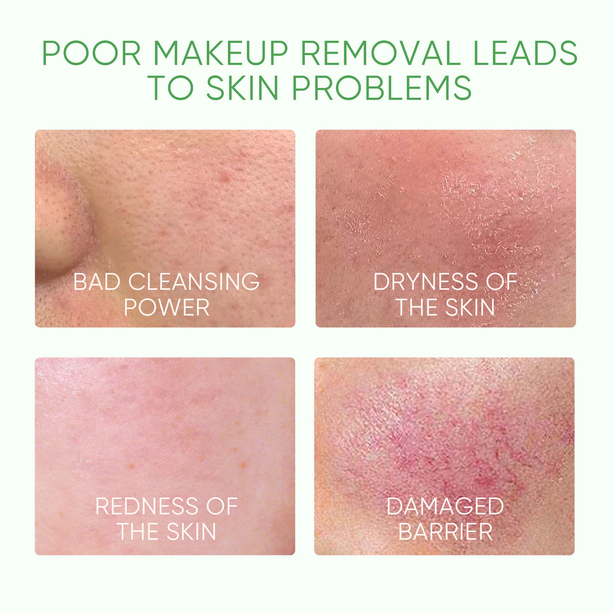 Mugwort Purifying Micellar Makeup Remover with Ceramide & Centella