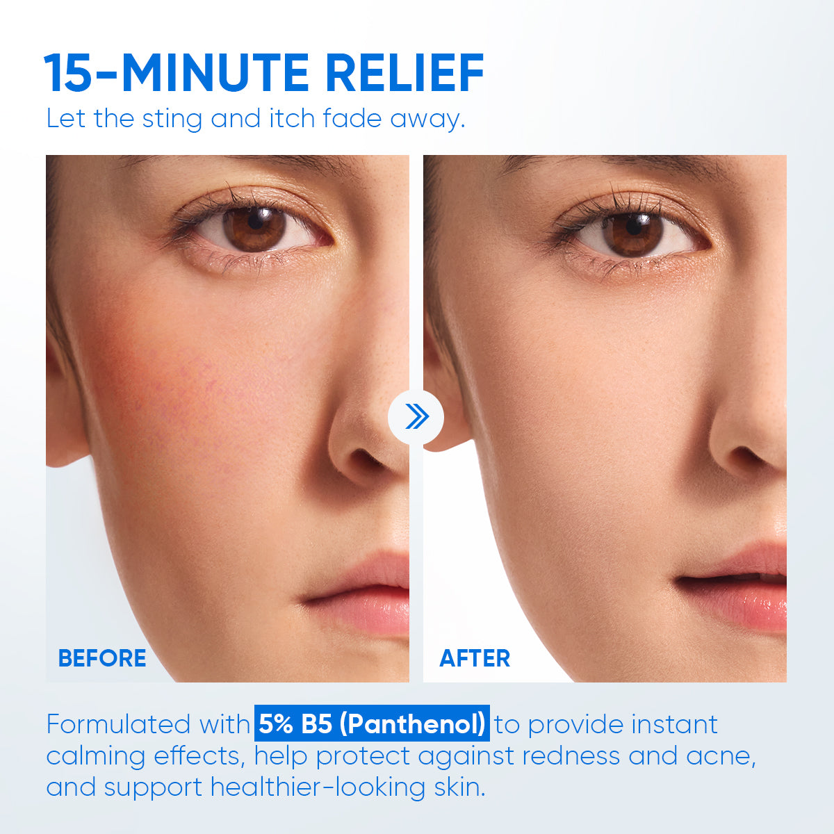 Hidratante Reparador de Barrera con 5% B5 y Ceramidas