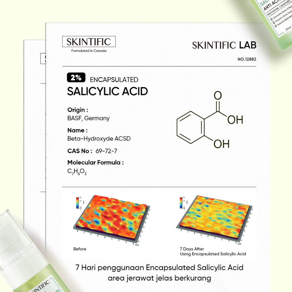2% Salicylic Acid Serum Acne Treatment & Pore Clearing